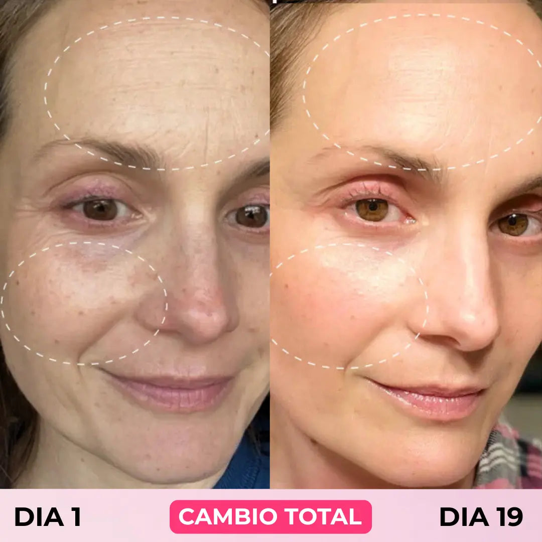 ADN DE SALMON - Serum Coreano